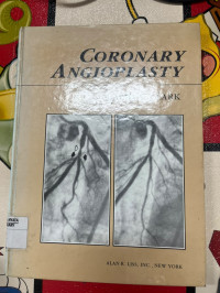 Image of Coronary Angioplasty