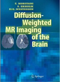 Image of Diffusion-Weighted MR Imaging of the Brain