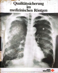 Image of Qualitätssicherung im medizinischen Röntgen